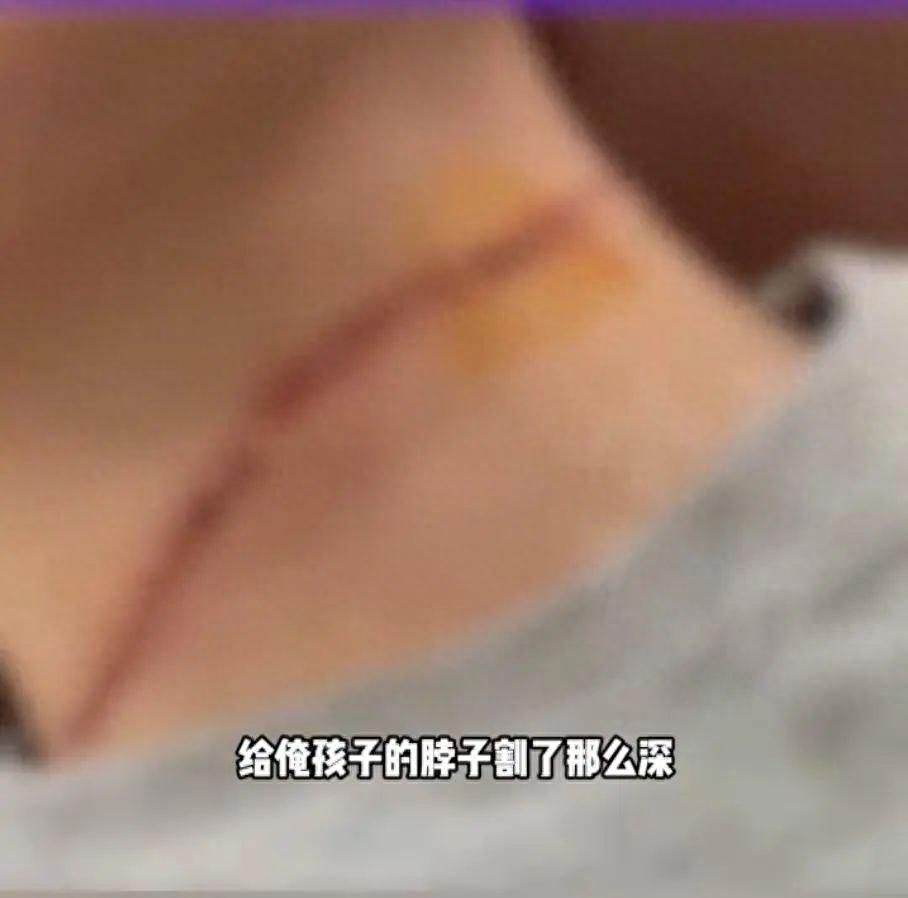 隐形刀加拿大鹅会报警吗_隐形刀的实用性_隐形刀