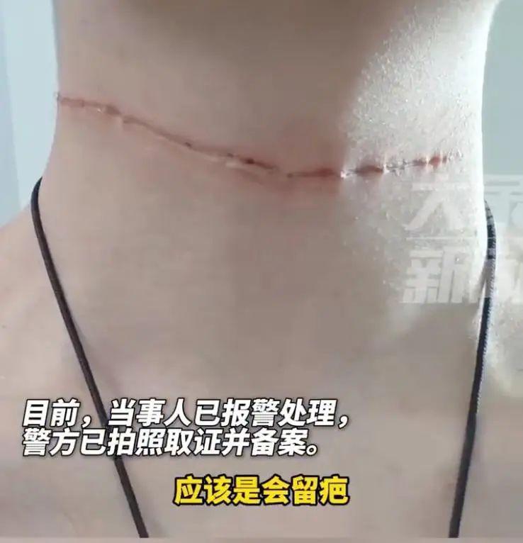 隐形刀的实用性_隐形刀加拿大鹅会报警吗_隐形刀