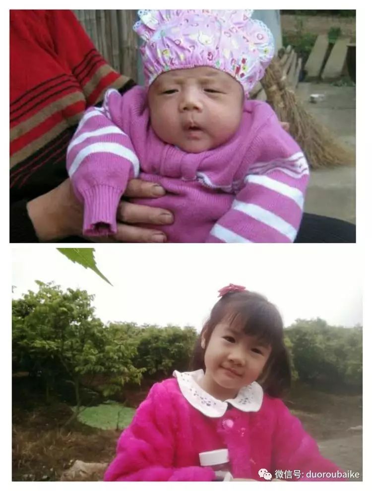 多肉叶子黑斑掉叶_多肉叶斑病_多肉黑王子掉叶子长斑